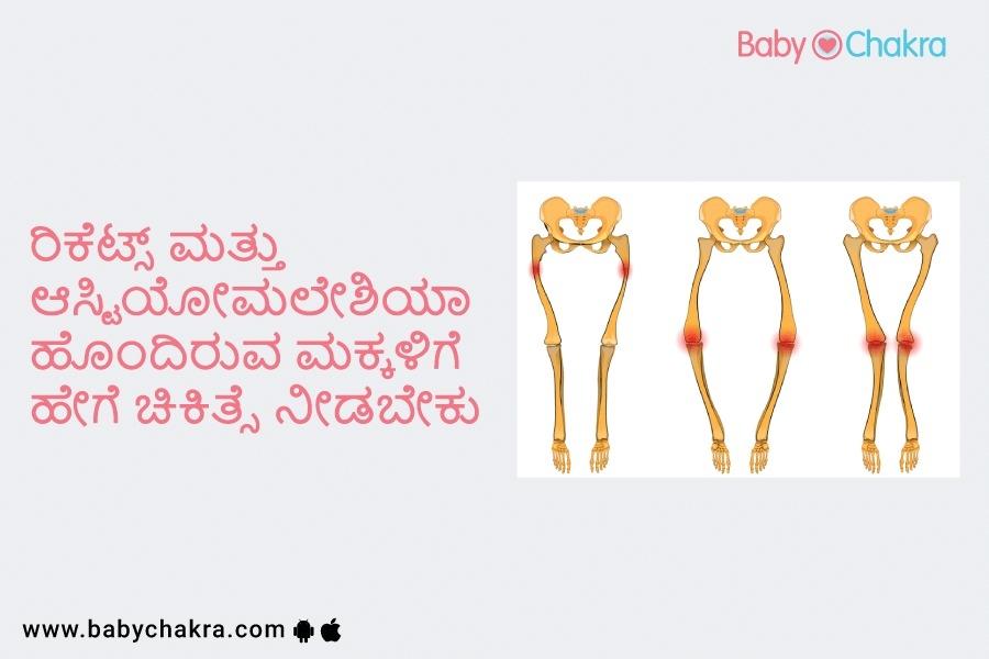 ರಿಕೆಟ್ಸ್ ಮತ್ತು ಆಸ್ಟಿಯೋಮಲೇಶಿಯಾ ಹೊಂದಿರುವ ಮಕ್ಕಳಿಗೆ ಹೇಗೆ ಚಿಕಿತ್ಸೆ ನೀಡಬೇಕು